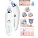 Dermasuction Wireless – Removedor de Cravos Sem Fio para Limpeza Profunda e Cuidados FaciaisDermasuction Wireless – Removedor de Cravos Sem Fio para Limpeza Profunda e Cuidados Faciais