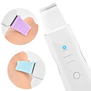 Peeling Ultrassônico Facial Portátil – Limpador de Pele, Anti-Rugas e Removedor de Cravos com Ionização Sônica