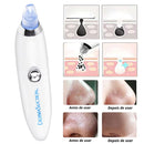 Dermasuction Wireless – Removedor de Cravos Sem Fio para Limpeza Profunda e Cuidados FaciaisDermasuction Wireless – Removedor de Cravos Sem Fio para Limpeza Profunda e Cuidados Faciais